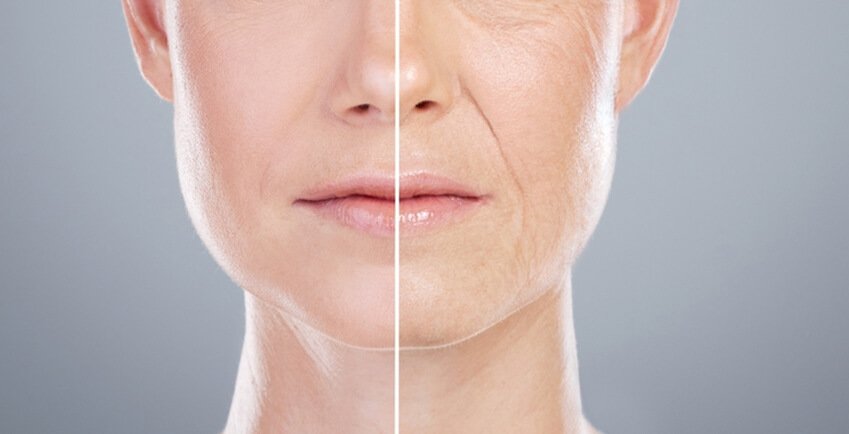 IV Anti-Aging